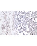 GCM1 Polyclonal antibody 21724-1-AP proteintech