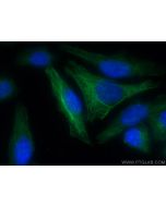 KANK2 Polyclonal antibody 21733-1-AP proteintech