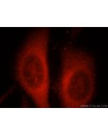 RAPGEFL1 Polyclonal antibody 21746-1-AP proteintech