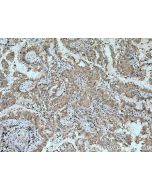 RASSF7 Polyclonal antibody 21753-1-AP proteintech