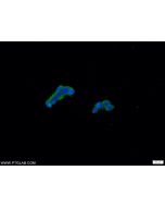 CCHCR1 Polyclonal antibody 21869-1-AP proteintech