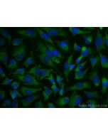 VAV2 Polyclonal antibody 21924-1-AP proteintech