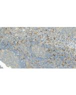 DC-SIGNR/CD299 Polyclonal antibody 22003-1-AP proteintech