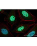 ZNF718 Polyclonal antibody 22074-1-AP proteintech