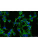 ERC1 Polyclonal antibody 22211-1-AP proteintech
