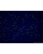 MPO Polyclonal antibody 22225-1-AP proteintech