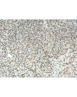 REST Polyclonal antibody 22242-1-AP proteintech
