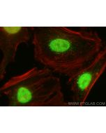 ASF1B-specific Polyclonal antibody 22258-1-AP proteintech