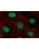 ASF1A-specific Polyclonal antibody 22259-1-AP proteintech