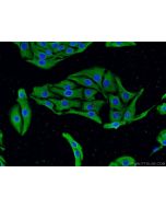 CACNA1D Polyclonal antibody 22276-1-AP proteintech