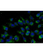 TGF-alpha Polyclonal antibody 22308-1-AP proteintech