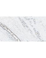 CXCL9/MIG Polyclonal antibody 22355-1-AP proteintech