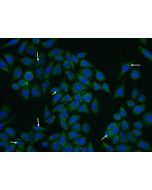 CEP290 Polyclonal antibody 22490-1-AP proteintech