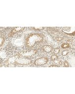 TFAM Polyclonal antibody 22586-1-AP proteintech