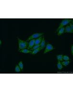 PPP4R2 Polyclonal antibody 22676-1-AP proteintech