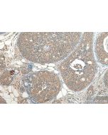 CCDC64B Polyclonal antibody 22770-1-AP proteintech