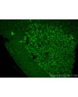 LIFR Polyclonal antibody 22779-1-AP proteintech