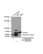 HIC2 Polyclonal antibody 22788-1-AP proteintech