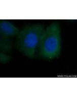 SHE Polyclonal antibody 22902-1-AP proteintech