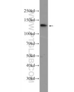SALL2 Polyclonal antibody 23114-1-AP proteintech