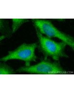 CIP2A Polyclonal antibody 23199-1-AP proteintech