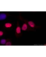 EVI1 Polyclonal antibody 23201-1-AP proteintech