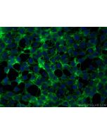KCNN4 Polyclonal antibody 23271-1-AP proteintech
