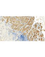 KHDC1 Polyclonal antibody 23443-1-AP proteintech