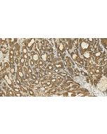 PRELP Polyclonal antibody 23783-1-AP proteintech