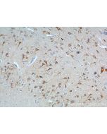 NPBWR2 Polyclonal antibody 24162-1-AP proteintech
