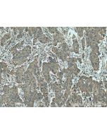 C6orf141 Polyclonal antibody 24355-1-AP proteintech