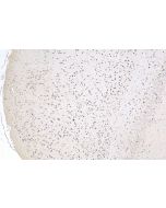 DNER Polyclonal antibody 24362-1-AP proteintech