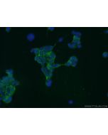 GPATCH4 Polyclonal antibody 24399-1-AP proteintech