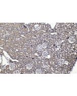 GTF2E1 Polyclonal antibody 24405-1-AP proteintech