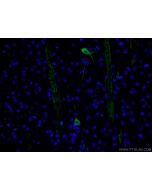 CHAT Polyclonal antibody 24418-1-AP proteintech