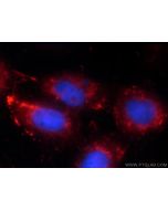 RRP7A Polyclonal antibody 24490-1-AP proteintech