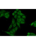 RPRD1B Polyclonal antibody 24542-1-AP proteintech