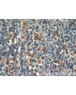POTEA Polyclonal antibody 24593-1-AP proteintech