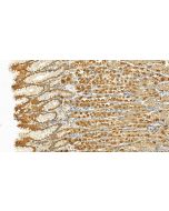 ZDHHC13 Polyclonal antibody 24759-1-AP proteintech