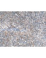 MOSC2 Polyclonal antibody 24782-1-AP proteintech