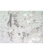 TMEM154 Polyclonal antibody 24812-1-AP proteintech