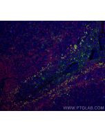 VISTA Polyclonal antibody 24849-1-AP proteintech