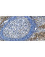 EVI2B Polyclonal antibody 24891-1-AP proteintech