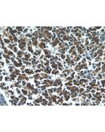 HCLS1 Polyclonal antibody 25003-1-AP proteintech