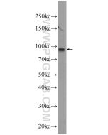 TMCC2 Polyclonal antibody 25042-1-AP proteintech