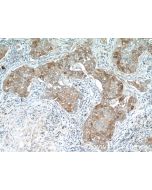 TMEM87A Polyclonal antibody 25091-1-AP proteintech