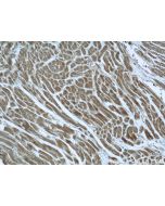 Syncoilin Polyclonal antibody 25151-1-AP proteintech
