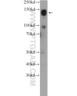 CHL1 Polyclonal antibody 25250-1-AP proteintech