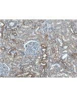 TBC1D24 Polyclonal antibody 25254-1-AP proteintech