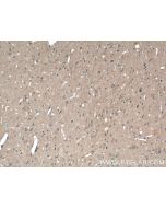 ABCA7 Polyclonal antibody 25339-1-AP proteintech